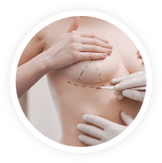 Breast Surgery